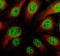 Immunofluorescent staining of TRIM11 using anti-TRIM11 antibody (green) and anti-Alpha Tubulin antibody (red). TRIM11 was detected in an immunocytochemical section of HELA cells. Enzyme antigen retrieval was performed using IHC enzyme antigen retrieval reagent for 15 mins. The cells were blocked with 10% goat serum. And then incubated with 5 ug/ml rabbit anti-TRIM11 antibody and mouse anti-Beta Tubulin antibody overnight at 4oC.
