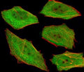 Fluorescent image of U251 cells stained with VCP antibody at 1:25. An Alexa Fluor 488-conjugated goat anti-mouse lgG was used as the secondary Ab (green). Cytoplasmic actin was counterstained with Alexa Fluor 555 conjugated with Phalloidin (red).