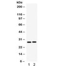 Western blot testing of 1) rat kidney and 2) mouse kidney lysate with IGFBP1 antibody. Expected molecular weight: 28-35 kDa.