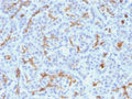 IHC testing of FFPE human pancreas with CFTR antibody (clone M3A7). Staining of FFPE tissue is enhanced by boiling tissue sections in 10mM Tris with 1mM EDTA, pH9 for 10-20 min followed by cooling at RT for 20 min.