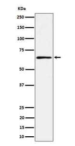 Western blot analysis of RIPK2 in human K562 cell lysate using RIPK2 antibody. Expected molecular weight ~61 kDa.