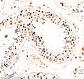 IHC analysis of TAF5 using anti-TAF5 antibody. TAF5 was detected in a paraffin-embedded section of human testis tissue. Heat mediated antigen retrieval was performed in EDTA buffer (pH 8.0, epitope retrieval solution). The tissue section was blocked with 10% goat serum. The tissue section was then incubated with 2 ug/ml rabbit anti-TAF5 antibody overnight at 4oC. Peroxidase Conjugated Goat Anti-rabbit IgG was used as secondary antibody and incubated for 30 min at 37oC.