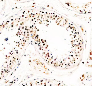 IHC analysis of TAF5 using anti-TAF5 antibody. TAF5 was detected in a paraffin-embedded section of human testis tissue. Heat mediated antigen retrieval was performed in EDTA buffer (pH 8.0, epitope retrieval solution). The tissue section was blocked with 10% goat serum. The tissue section was then incubated with 2 ug/ml rabbit anti-TAF5 antibody overnight at 4oC. Peroxidase Conjugated Goat Anti-rabbit IgG was used as secondary antibody and incubated for 30 min at 37oC.