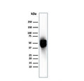 Western blot testing of human spleen tissue with recombinant Thymidine Phosphorylase antibody. Predicted molecular weight ~55 kDa.
