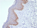 IHC staining of FFPE human skin tissue with Cytokeratin 15 antibody (clone KRT15/8312R). HIER: boil tissue sections in pH 9 10mM Tris with 1mM EDTA for 20 min and allow to cool before testing.