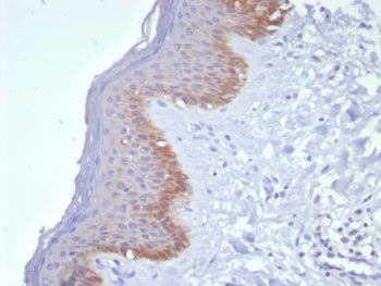 IHC staining of FFPE human skin tissue with Cytokeratin 15 antibody (clone KRT15/8312R). HIER: boil tissue sections in pH 9 10mM Tris with 1mM EDTA for 20 min and allow to cool before testing.