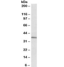Western blot testing of human spinal cord cancer lysate with CD38 antibody at 2ug/ml. Expected molecular weight: 34-46 kDa.
