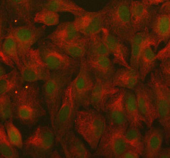 Immunofluorescent staining of RANBP9 using anti-RANBP9 antibody (green) and anti-Beta Tubulin antibody (red). RANBP9 was detected in immunocytochemical section of cell. Enzyme antigen retrieval was performed using IHC enzyme antigen retrieval reagent for 15 mins. The cells were blocked with 10% goat serum. And then incubated with 5 ug/ml rabbit anti-RANBP9 antibody and mouse anti-Beta Tubulin antibody overnight at 4oC.