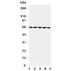 Western blot testing of RGS14 antibody and Lane 1: rat thymus; 2: (r) spleen; 3: human Raji; 4: (h) CEM; 5: (h) Jurkat cell lysate. Expected/observed size ~65KD