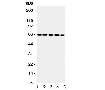 Western blot testing of RGS14 antibody and Lane 1: rat thymus; 2: (r) spleen; 3: human Raji; 4: (h) CEM; 5: (h) Jurkat cell lysate. Expected/observed size ~65KD