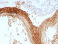 IHC staining of FFPE human skin tissue with recombinant Basic Cytokeratin antibody (clone rKRTH/8883). HIER: boil tissue sections in pH 9 10mM Tris with 1mM EDTA for 20 min and allow to cool before testing.