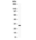 Western blot testing of rat eye lysate with AQP0 antibody. Observed molecular weight: 28-60 kDa depending on level of glycosylation.
