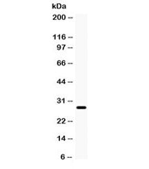 Western blot testing of rat eye lysate with AQP0 antibody. Observed molecular weight: 28-60 kDa depending on level of glycosylation.