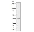 Western blot testing of human HepG2 cell lysate with Farnesyl Diphosphate Synthase antibody. Predicted molecular weight: 48/41 kDa (two isoforms).