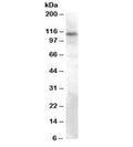 Western blot testing of rat brain lysate with TRPC4 antibody at 0.3ug/ml. Predicted/observed molecular weight: ~112kDa.