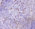 IHC staining of FFPE human tonsil with CXCL12 antibody at 0.5ug/ml. HIER: boil tissue sections in pH6, 10mM citrate buffer, for 10-20 min followed by cooling at RT for 20 min.