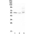 Western blot testing of human 1) Raji, 2) HeLa, and 3) SW620 cell lysate with D6 antibody at 0.5ug/ml. Predicted molecular weight ~43 kDa, can be observed at 50-55 kDa.