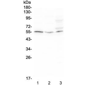 Western blot testing of human 1) Raji, 2) HeLa, and 3) SW620 cell lysate with D6 antibody at 0.5ug/ml. Predicted molecular weight ~43 kDa, can be observed at 50-55 kDa.