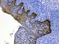 IHC testing of FFPE human tonsil tissue with Cytokeratin 5 antibody at 1ug/ml. HIER: steam section in pH6 citrate buffer for 20 min.