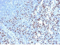 IHC staining of FFPE human lymph node with recombinant LEF1 antibody (clone rLEF1/6906) at 2ug/ml in PBS for 30min RT. Strong nuclear staining of non-germinal center observed. HIER: boil tissue sections in pH 9 10mM Tris with 1mM EDTA for 20 min and allow to cool before testing.
