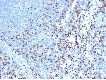 IHC staining of FFPE human lymph node with recombinant LEF1 antibody (clone rLEF1/6906) at 2ug/ml in PBS for 30min RT. Strong nuclear staining of non-germinal center observed. HIER: boil tissue sections in pH 9 10mM Tris with 1mM EDTA for 20 min and allow to cool before testing.