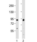 Western blot testing of human 1) HeLa and 2) Jurkat cell lysate with ACO2 antibody at 1:1000. Predicted molecular weight ~85 kDa.