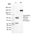 SDS-PAGE analysis of purified, BSA-free CD29 antibody (clone 12G10) as confirmation of integrity and purity.