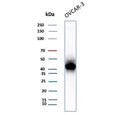 Western blot testing of human OVCAR-3 cell lysate with MSLN antibody. Predicted molecular weight ~70 kDa (precursor), ~40 kDa (processed form).