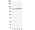 Western blot testing of ICAM1 antibody and rat samples 1: thymus; 2: spleen; 3: PC12; 4: NRK; 5: RH35 lysate. The expected molecular weight of this glycoprotein is 75~115 kDa.