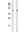 Western blot testing of ACAT1 antibody at 1:2000 dilution. Lane 1: human SW620 lysate; 2: mouse liver lysate; Predicted molecular weight: ~45kDa.