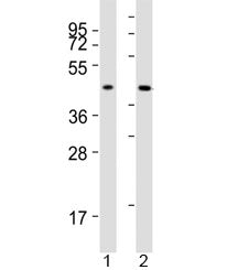 Western blot testing of ACAT1 antibody at 1:2000 dilution. Lane 1: human SW620 lysate; 2: mouse liver lysate; Predicted molecular weight: ~45kDa.