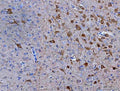 IHC staining of FFPE rat brain tissue with Neuromedin-S antibody. HIER: boil tissue sections in pH8 EDTA for 20 min and allow to cool before testing.