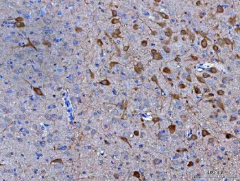 IHC staining of FFPE rat brain tissue with Neuromedin-S antibody. HIER: boil tissue sections in pH8 EDTA for 20 min and allow to cool before testing.