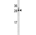 Western blot testing of HOXA7 antibody + human WiDr lysate. Predicted molecular weight ~25 kDa.