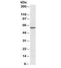 Western blot testing of mouse kidney lysate with ANTXR2 antibody at 0.3ug/ml. Predicted molecular weight: ~54 kDa.