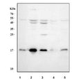 Western blot testing of 1) human placenta, 2) human K562, 3) human HepG2, 4) rat brain and 5) rat kidney tissue lysate with UBC9 antibody. Predicted molecular weight ~18 kDa.