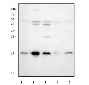 Western blot testing of 1) human placenta, 2) human K562, 3) human HepG2, 4) rat brain and 5) rat kidney tissue lysate with UBC9 antibody. Predicted molecular weight ~18 kDa.