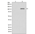 Western blot testing of lysate from 1) untreated and 2) AP-treated human K562 cells with phospho-IRE1 antibody. Predicted molecular weight ~110 kDa.