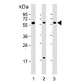Western blot testing of human 1) HepG2, 2) K562 and 3) Raji cell lysate using TGFB1 antibody. Predicted molecular weight: 44-50 kDa (precursor), ~25 kDa (active form).