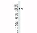 Western blot analysis of Dnmt3a antibody in T47-D cell lysate. Predicted molecular weight: 100-130 kDa