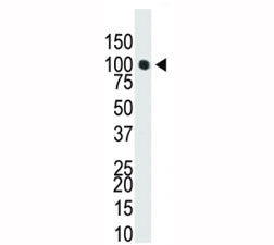 Western blot analysis of Dnmt3a antibody in T47-D cell lysate. Predicted molecular weight: 100-130 kDa