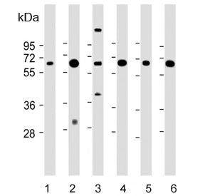 Western blot testing of 1) human liver, 2) human kidney, 3) human NCI-H460, 4) mouse liver, 5) mouse kidney and 6) rat kidney lysate with PEPCK1 antibody. Predicted molecular weight: ~69 kDa.