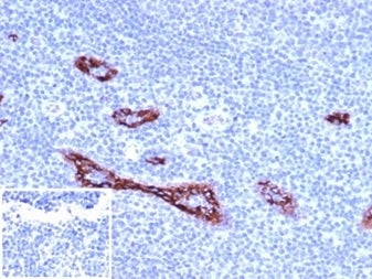 IHC staining of FFPE human tonsil tissue with von Willebrand Factor antibody (clone VWF/4106). Negative control inset: PBS used instead of primary antibody to control for secondary Ab binding. HIER: boil tissue sections in pH 9 10mM Tris with 1mM EDTA for 20 min and allow to cool before testing.