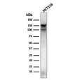 Western blot testing of human HCT116 lysate with MSH6 antibody (clone MSH6/3089). Expected molecular weight: 120-160 kDa depending on phosphorylation level.