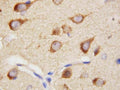 IHC staining of FFPE rat brain tissue with PPID antibody. HIER: boil tissue sections in pH8 EDTA for 20 min and allow to cool before testing.
