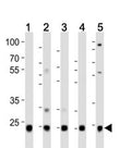 Western blot analysis of lysate from HeLa (1), HepG2 (2), Jurkat (3), mouse liver (4) , rat kidney  (5) lysate using UBB/ Ubiquitin antibody at 1:1000.