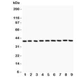 Western blot testing of APE1 antibody and Lane 1: rat NRK; 2: human HeLa; 3: rat PC12; 4: rat RH35; 5: mouse HEPA; 6: human MCF7: human A549; 8: human placenta; 9: human A431 lysate. Expected molecular weight: ~38 kDa.