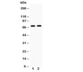 Western blot testing with MEKK3 antibody Lane 1: rat brain; 2: mouse brain. Expected size ~71KD