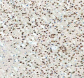 IHC staining of FFPE mouse brain tissue with Fox2 antibody. HIER: boil tissue sections in pH8 EDTA for 20 min and allow to cool before testing.