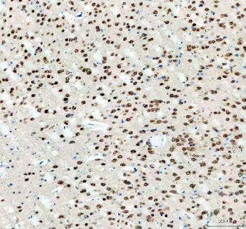 IHC staining of FFPE mouse brain tissue with Fox2 antibody. HIER: boil tissue sections in pH8 EDTA for 20 min and allow to cool before testing.